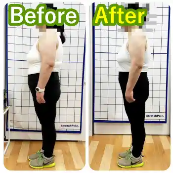 30代女性のビフォーアフター