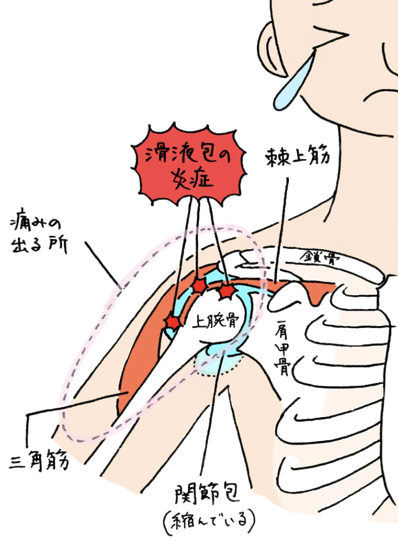 五十肩・肩関節周囲炎