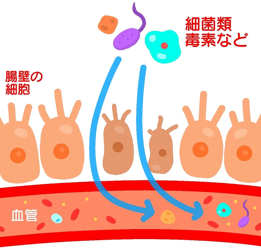 リーキーガット症候群