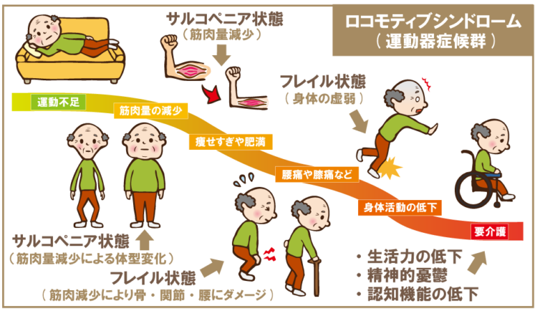 高齢者こそ筋トレが必要な理由｜90歳でも続けられる体づくり