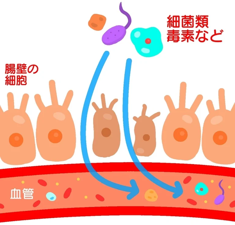 「腸漏れ（リーキーガット）」が痩せない原因？知られざるダイエットの落とし穴とは