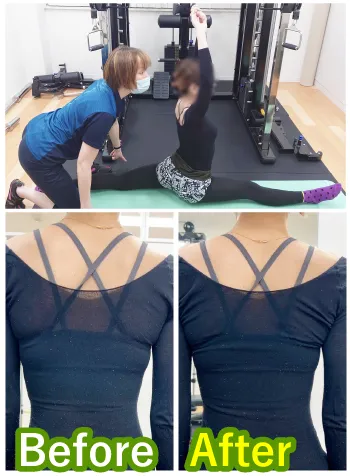 30代女性M様のビフォーアフター写真