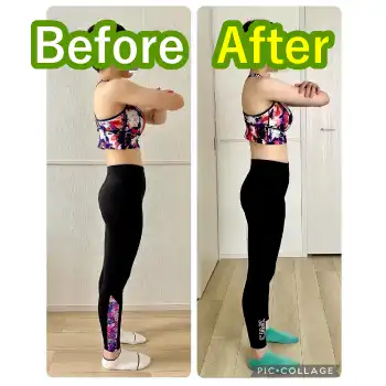 20代女性N様のビフォーアフター写真。姿勢が改善した様子