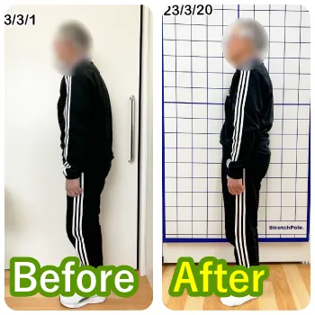 80代男性N様のビフォーアフター写真。姿勢が改善した様子